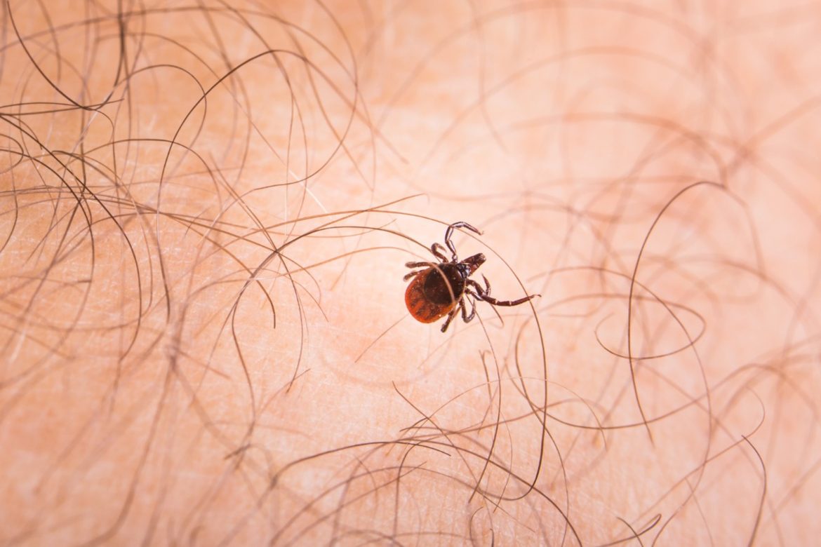 suspeita-de-morte-de-menino-por-febre-maculosa-em-juiz-de-fora-e-descartada