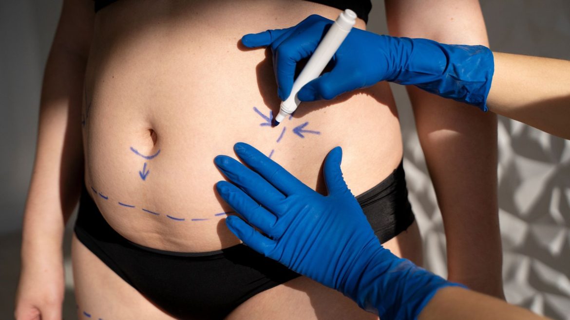 lipoaspiracao:-como-e-feita-e-quais-os-riscos-do-procedimento?