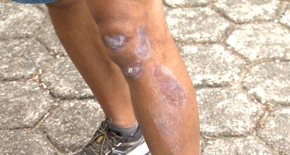 fio-solto-joga-motociclista-para-o-alto-em-juiz-de-fora:-‘tive-varias-cicatrizes-pelo-corpo’