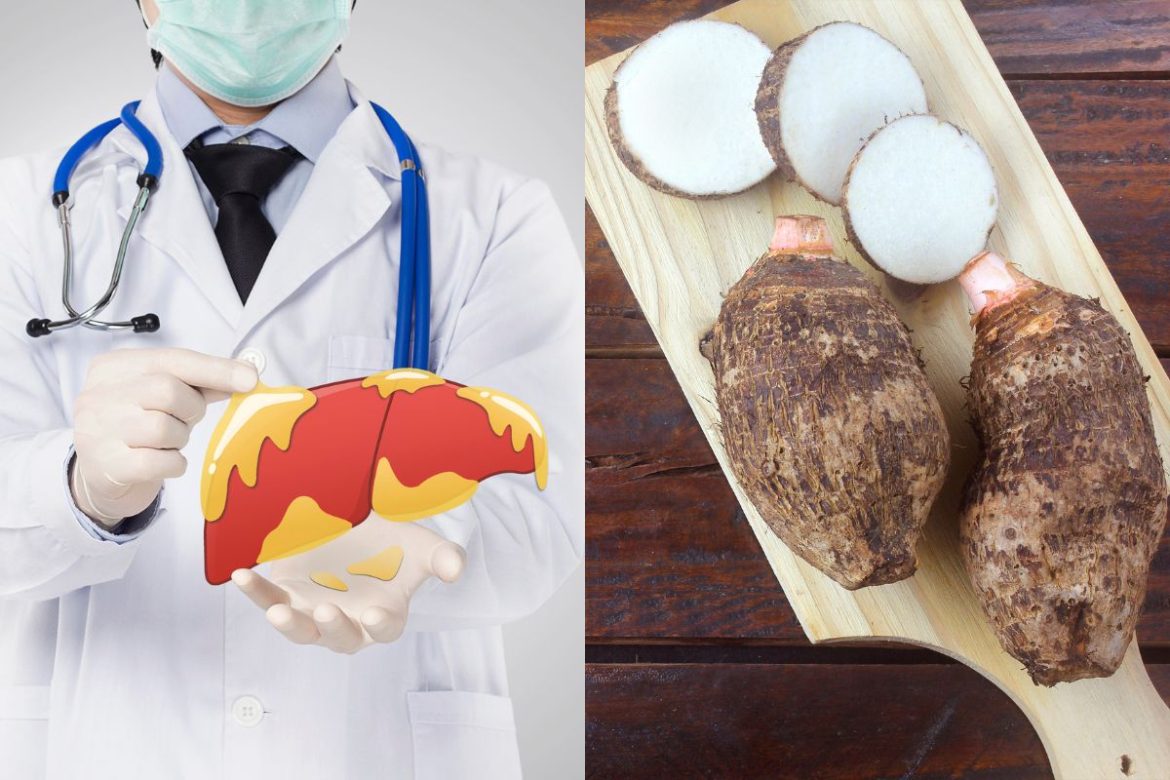 quem-tem-gordura-no-figado-pode-comer-inhame?-descubra