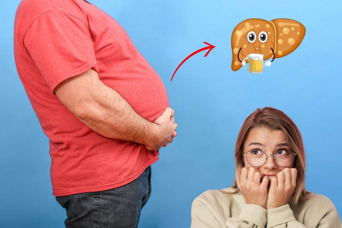 10-sinais-que-indicam-gordura-no-figado:-fique-atento