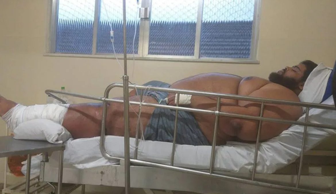 com-mais-de-300-kg,-jovem-faz-vaquinha-on-line-para-pagar-tratamento-em-mg;-saiba-como-ajudar