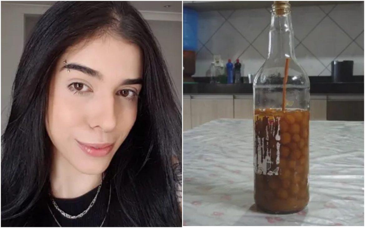 um-ano-apos-ter-grave-reacao-alergica-a-pimenta,-jovem-nao-anda-e-nem-consegue-falar