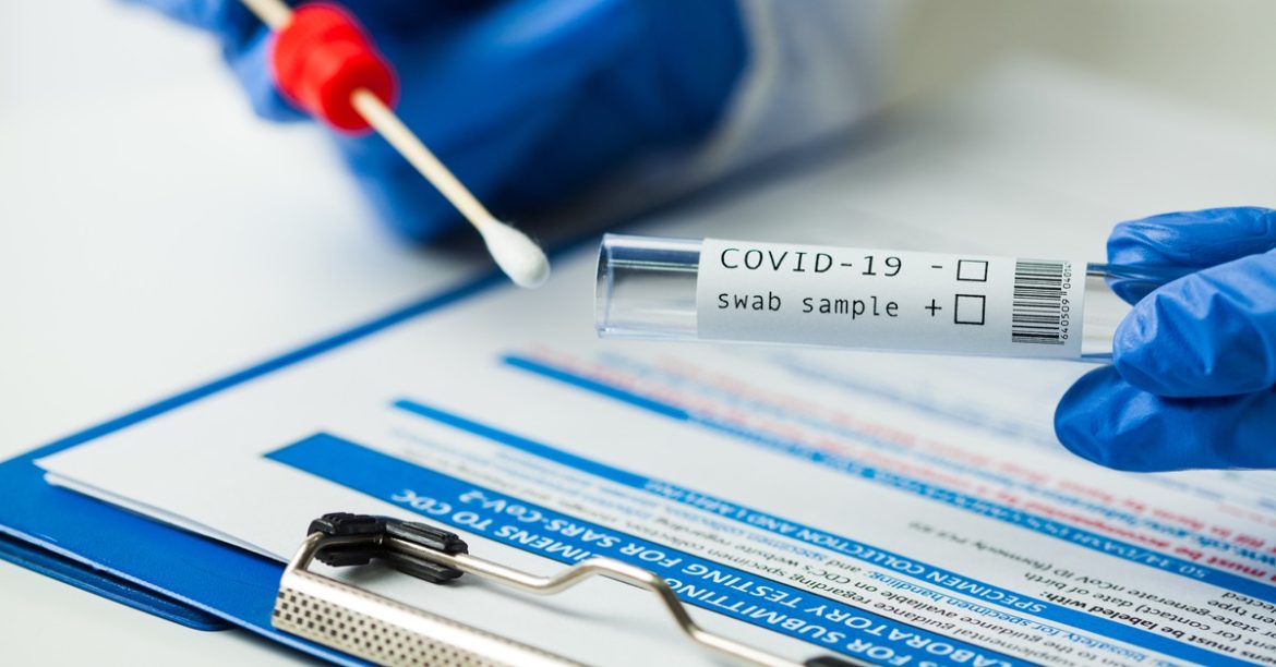 o-que-e-pcr? o-que-e-pcr?